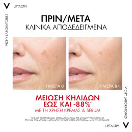 LIFTACTIV PIGMENT B3 SPECIALIST ΜΕ SPF50 3