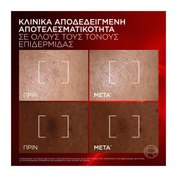 REVITALIFT TRIPLE LASER SERUM ΑΝΤΙΓΗΡΑΝΤΙΚΟΣ ΚΡΕΜΩΔΗΣ ΟΡΟΣ 7