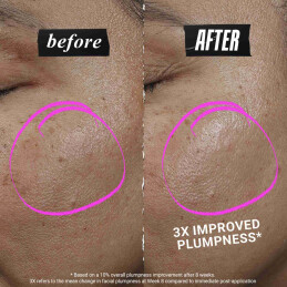 COLLASHOT PLUMP SERUM ΟΡΟΣ ΠΡΟΣΩΠΟΥ ΓΙΑ ΕΠΑΝΑΦΟΡΑ ΟΓΚΟΥ 2