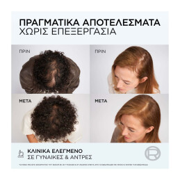 ELVIVE GROWTH BOOSTER x2 SERUM ΚΑΤΑ ΤΗΣ ΤΡΙΧΟΠΤΩΣΗΣ 7