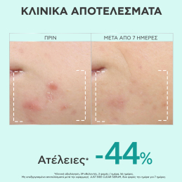 JUST BEE CLEAR SERUM 5