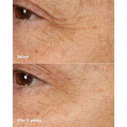 SMART CLINICAL REPAIR™ OVERNIGHT RECOVERY CREAM + MASK 2