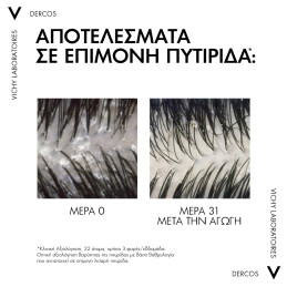 DERCOS ANTI-DANDRUFF DS ΣΑΜΠΟΥΑΝ ΚΑΤΑ ΤΗΣ ΞΗΡΟΔΕΡΜΙΑΣ, ΤΗΣ ΠΙΤΥΡΙΔΑΣ ΚΑΙ ΤΟΥ ΚΝΗΣΜΟΥ ΓΙΑ ΚΑΝΟΝΙΚΑ - ΛΙΠΑΡΑ ΜΑΛΛΙΑ REFILL 3