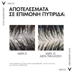 DERCOS ANTI-DANDRUFF DS ΣΑΜΠΟΥΑΝ ΚΑΤΑ ΤΗΣ ΞΗΡΟΔΕΡΜΙΑΣ, ΤΗΣ ΠΙΤΥΡΙΔΑΣ ΚΑΙ ΤΟΥ ΚΝΗΣΜΟΥ ΓΙΑ ΞΗΡΑ ΜΑΛΛΙΑ ECO REFILL 3