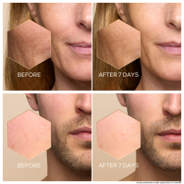 ABEILLE ROYALE YOUTH WATERY OIL SERUM 2