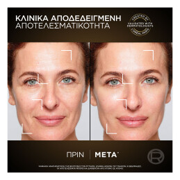AGE PERFECT ΚΥΤΤΑΡΙΚΗ ΑΝΑΠΛΑΣΗ ΚΡΕΜΑ ΝΥΚΤΟΣ MIDNIGHT 3