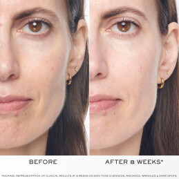 RENERGIE H.C.F. TRIPLE SERUM 4