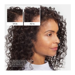 ANTI-HAIR LOSS ΣΑΜΠΟΥΑΝ ΚΑΤΑ ΤΗΣ ΤΡΙΧΟΠΤΩΣΗΣ 5