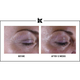 SUPER MULTI-CORRECTIVE EYE ZONE TREATMENT 16
