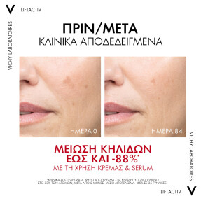 LIFTACTIV PIGMENT B3 SPECIALIST ΜΕ SPF50 | 50ml