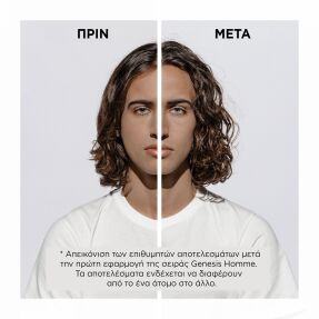 GENESIS HOMME ΑΝΔΡΙΚΟ SERUM ΚΑΤΑ ΤΗΣ ΤΡΙΧΟΠΤΩΣΗΣ ΓΙΑ ΠΥΚΝΩΣΗ