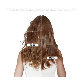 SYMBIOSE MICRO-PEELING ΑΝΤΙΠΙΤΥΡΙΔΙΚΗ ΠΕΡΙΠΟΙΗΣΗ ΜΙΚΡΟΑΠΟΛΕΠΙΣΗΣ | 200ml