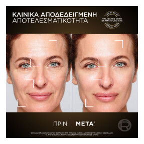 AGE PERFECT ΚΥΤΤΑΡΙΚΗ ΑΝΑΠΛΑΣΗ ΚΡΕΜΑ ΝΥΚΤΟΣ MIDNIGHT | 50ml