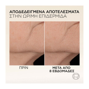 AGE PERFECT COLLAGEN EXPERT ANTI-SAGGING ΟΡΟΣ | 30ml