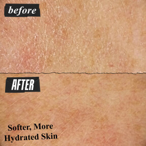 ULTRA FACIAL ΕΝΥΔΑΤΙΚΗ ΚΡΕΜΑ ΠΡΟΣΩΠΟΥ | 50ml