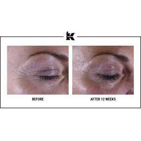 SUPER MULTI-CORRECTIVE EYE ZONE TREATMENT | 14ml