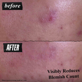 GENTLY EFFECTIVE BLEMISH-TARGETING CLEANSING PASTE | 125ml