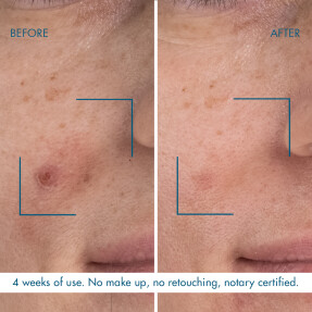 BLUE RETINOL NIGHT SERUM | 30ml