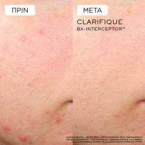 CLARIFIQUE BX-INTERCEPTOR™ SERUM | 30ml