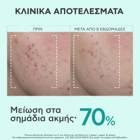 JUST BEE CLEAR SERUM | 30ml