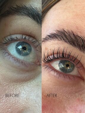 GROWTH SERUM | 3ml Clear