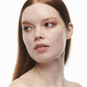 STUDIO RADIANCE SERUM-POWERED FOUNDATION | 30ml NC15