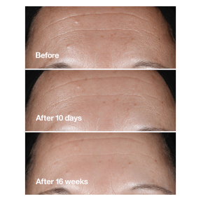 SMART CLINICAL REPAIR™ WRINKLE CORRECTING SERUM | 75ml