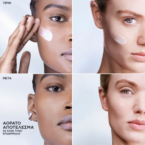 UV EXPERT SUPRA SCREEN SPF50+ ΑΝΤΗΛΙΑΚΟΣ ΟΡΟΣ ΠΡΟΣΩΠΟΥ | 40ml