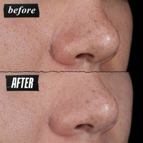 RARE EARTH DEEP PORE-MINIMIZING CLAY MASK | 125ml