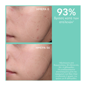 JUST BEE CLEAR ΚΡΕΜΑ ΚΑΤΑ ΤΩΝ ΑΤΕΛΕΙΩΝ | 40ml