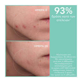 JUST BEE CLEAR GEL ΛΟΣΙΟΝ ΣΥΣΦΙΞΗΣ ΠΟΡΩΝ | 200ml