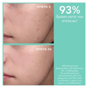 JUST BEE CLEAR ΣΕΤ ΚΑΤΑ ΤΩΝ ΑΤΕΛΕΙΩΝ ΕΝΥΔΑΤΩΣΗ & ΜΑΤ ΑΠΟΤΕΛΕΣΜΑ