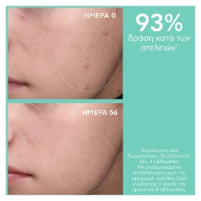 JUST BEE CLEAR ΣΕΤ ΚΑΤΑ ΤΩΝ ΑΤΕΛΕΙΩΝ ΕΝΥΔΑΤΩΣΗ & ΜΑΤ ΑΠΟΤΕΛΕΣΜΑ