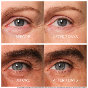 ABEILLE ROYALE YOUTH REPAIR EYE CARE | 15ml