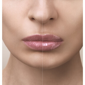 ABSOLUE THE LIP BALM | 12gr