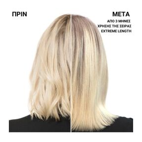 EXTREME LENGTH ΣΑΜΠΟΥΑΝ ΜΕ ΒΙΟΤΙΝΗ ΓΙΑ ΜΑΚΡΙΑ ΜΑΛΛΙΑ | 300ml