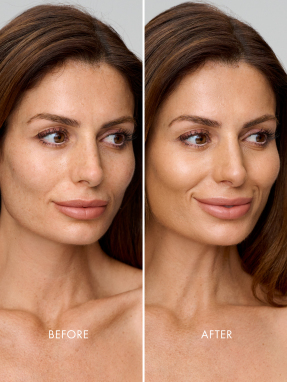 SWEED MIRACLE POWDER | 7gr 03 Golden Medium