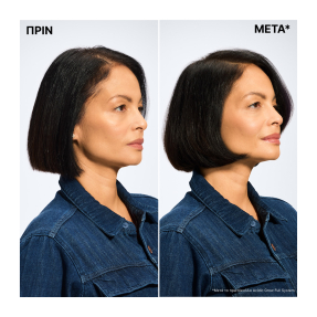 ACIDIC GROW FULL SYSTEM SERUM ΑΝΑΖΩΟΓΟΝΗΣΗΣ & ΕΝΥΔΑΤΩΣΗΣ | 100ml