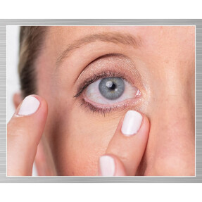 SUPER MULTI-CORRECTIVE EYE ZONE TREATMENT | 14ml