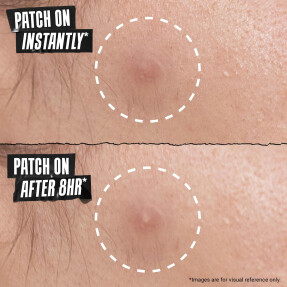 TRULY TARGETED OVERNIGHT BLEMISH PATCH | 22 patches
