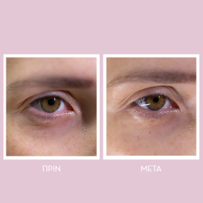 PEPTIDES SPRING HYDRA-GEL EYE PATCHES_1 ΖΕΥΓΑΡΙ