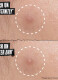 TRULY TARGETED OVERNIGHT BLEMISH PATCH 1
