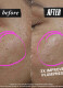 COLLASHOT PLUMP SERUM ΟΡΟΣ ΠΡΟΣΩΠΟΥ ΓΙΑ ΕΠΑΝΑΦΟΡΑ ΟΓΚΟΥ 2
