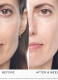 RENERGIE H.C.F. TRIPLE SERUM 8