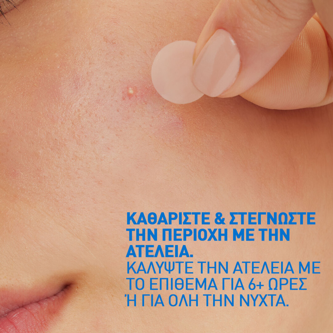 BLEMISH BARRIER PATCHES - ΑΥΤΟΚΟΛΛΗΤΑ ΕΠΙΘΕΜΑΤΑ ΚΑΤΑ ΤΩΝ ΑΤΕΛΕΙΩΝ 4