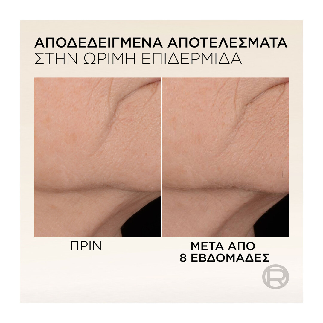 AGE PERFECT COLLAGEN EXPERT ANTI-SAGGING ΟΡΟΣ 5