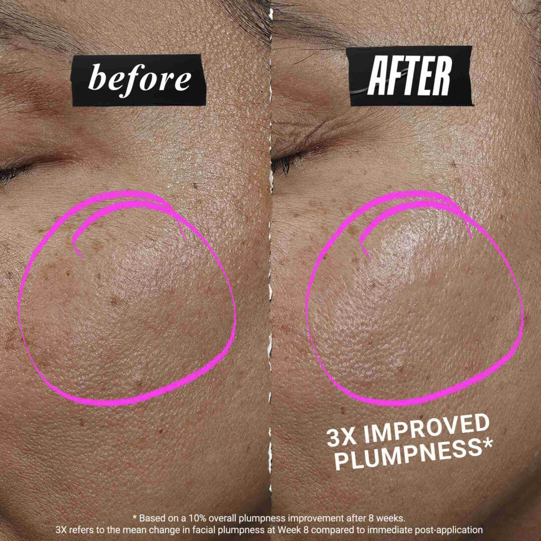 COLLASHOT PLUMP SERUM ΟΡΟΣ ΠΡΟΣΩΠΟΥ ΓΙΑ ΕΠΑΝΑΦΟΡΑ ΟΓΚΟΥ 2