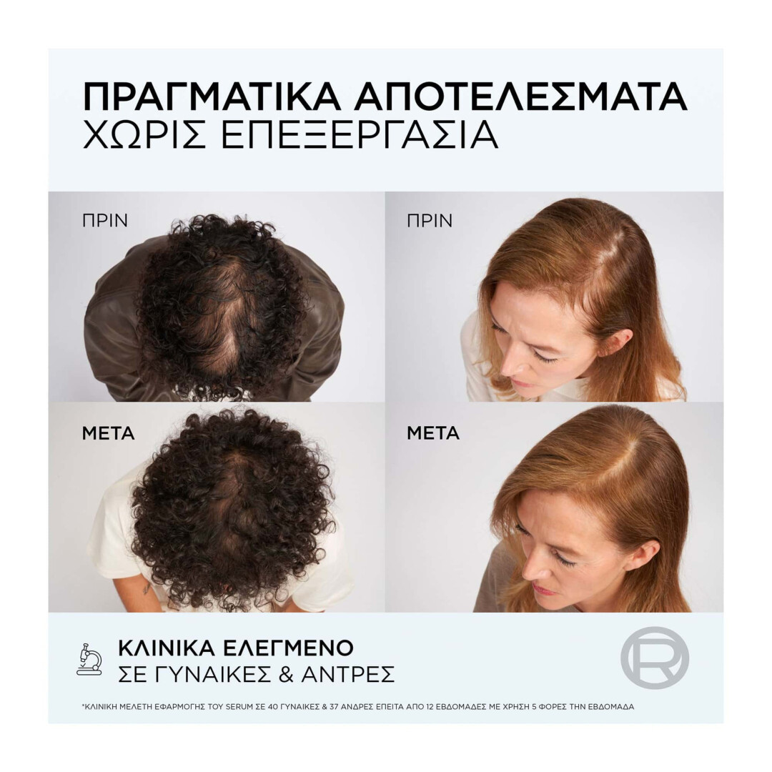 ELVIVE GROWTH BOOSTER x2 SERUM ΚΑΤΑ ΤΗΣ ΤΡΙΧΟΠΤΩΣΗΣ 7