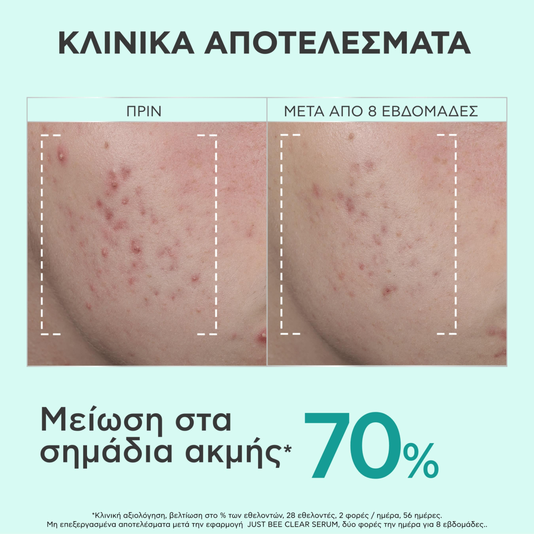 JUST BEE CLEAR SERUM 4