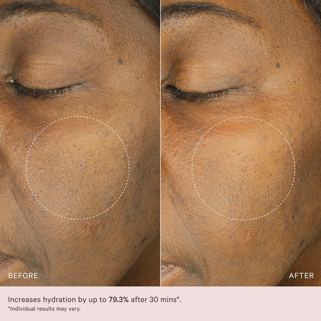 HYDRA-BOOST AMPOULES 2